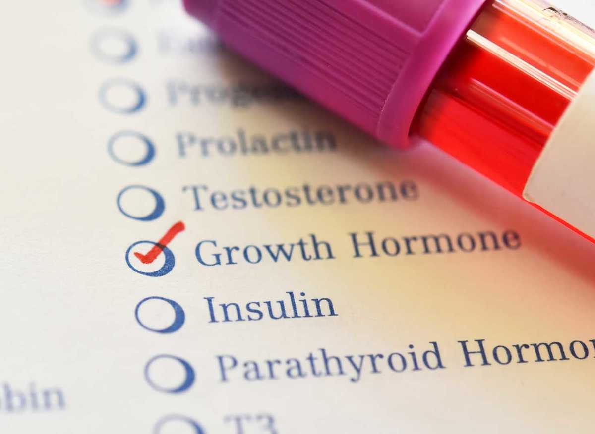 Understanding Dutch Testing and How it Can Help You Achieve Hormonal